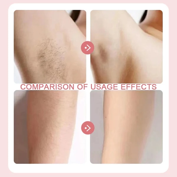 2-i-1 Bikini Trimmer Elektrisk Barbermaskine til Kvinder, Silky Glide Pro Hårfjerning til Barbering af Ben, Arme, Armhuler og Ansigt[ch] Pink