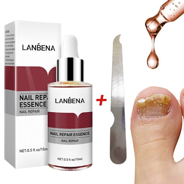 Nagelvård Nagelreparation Essens Fotvård