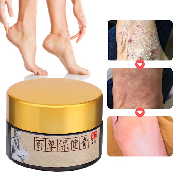 Fodlugt Behandling Deodorant Creme Salve Kløe Lindrende 20g