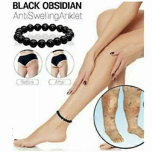 turvotusta ehkäisevä musta obsidiaani laihdutusnilkkakoru 10mm