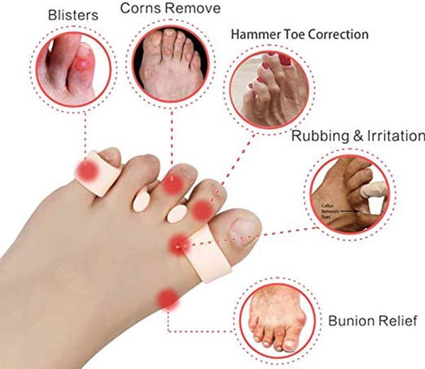 Gel tåskillere, 2 par / 4 stykker, til Hallux Valgus & hammertæer, smertelindring