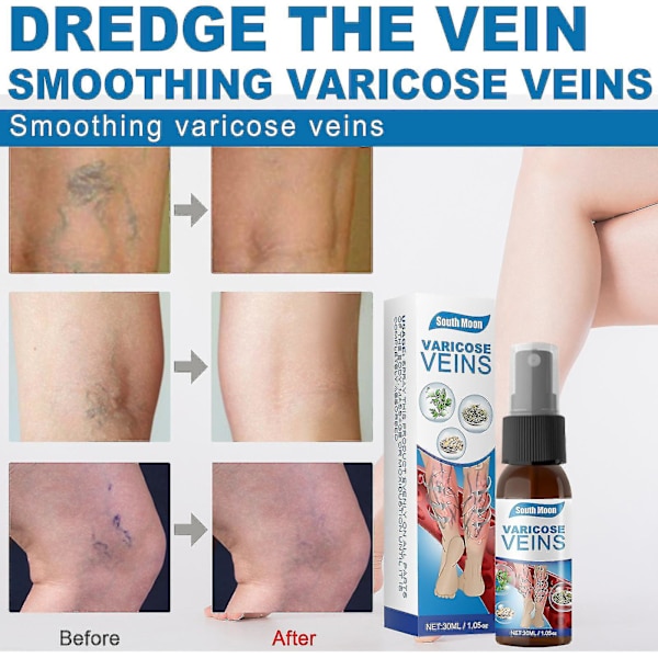 30ml Åderbråck Massage Smooth Ven Legs Revitalizing Spray