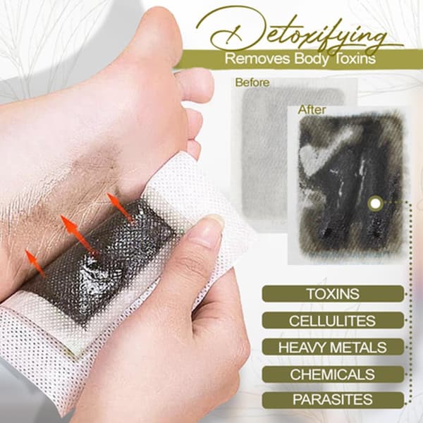 10-100ST Anti Svällning Ingefära Detoxing Patch Tongluo Foot Patch BrownA 10pcs