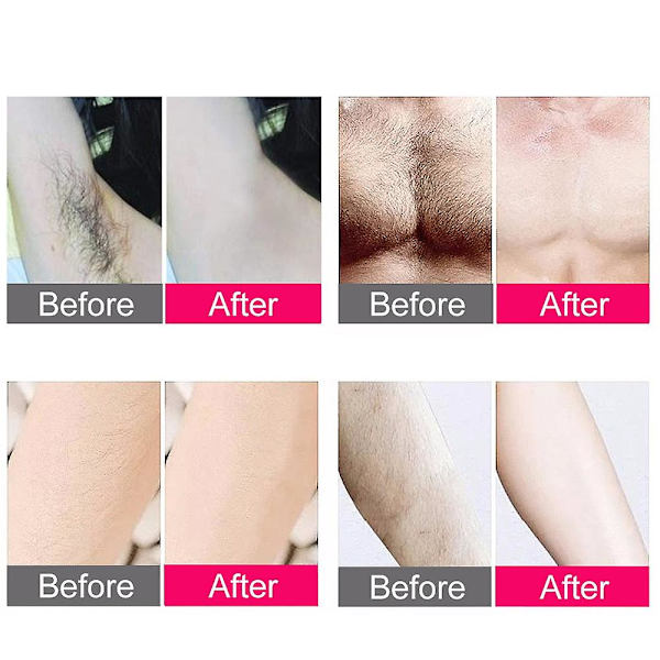 IPL Hårfjerning Laser Epilator 300000 Flash Barbering Og