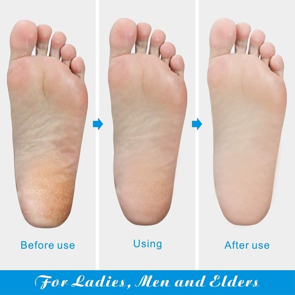 Kolossal Foot File och Foot Callus Remover
