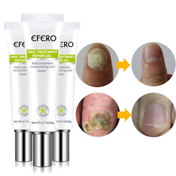3X EFERO Anti-svampegel til behandling af negleinfektioner - Hånd og Fod