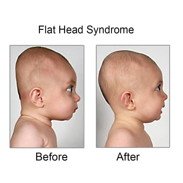 Baby mot flatt hode-deformasjon Flat hodeform Memory Foam pute Liten baby for baby (rosa) NO:9