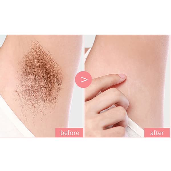 Kvinder Hårfjerner Smertfri Barbermaskine Bikini Ben Underarm Krop Tr Pink