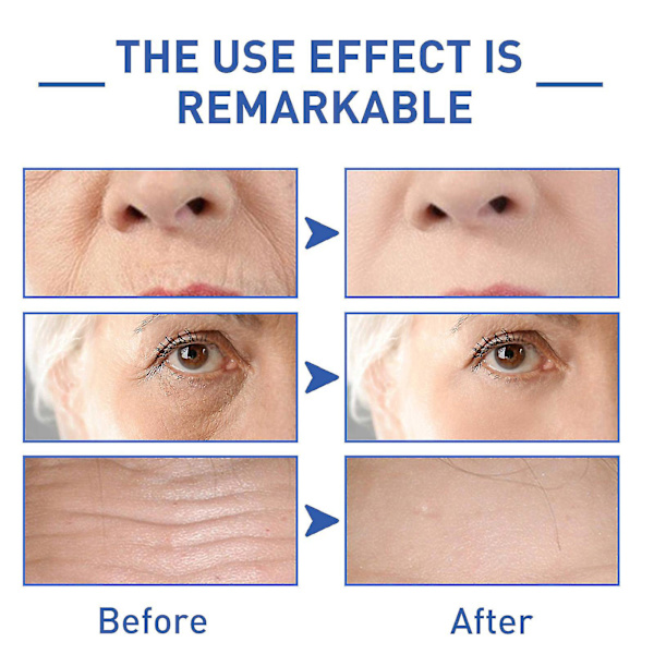 Eelhoe Water Light Cono Peptide Anti-rynk Essence null none