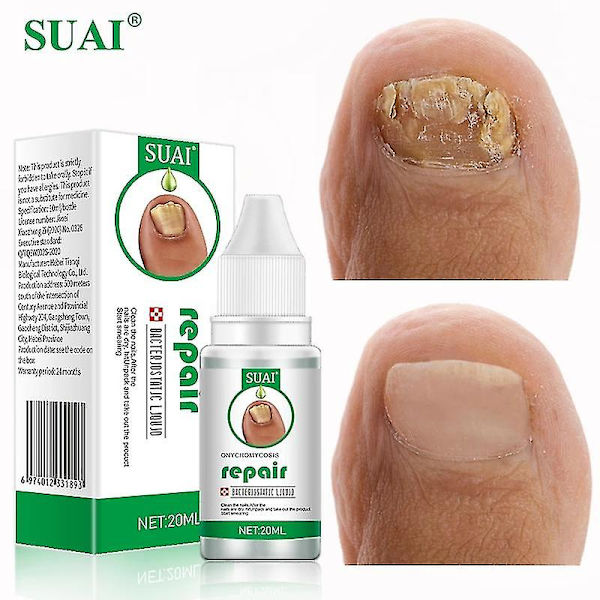 Suai-traitment Antifungal för naglar och fötter, essens, gel, anti-betection, 20ml null none