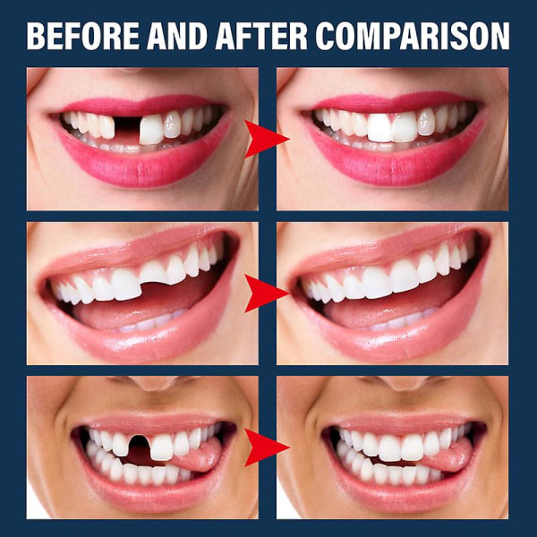 Gör-det-själv saknad tand Tillfällig ersättningständer Reparation Falsk Temp-tand