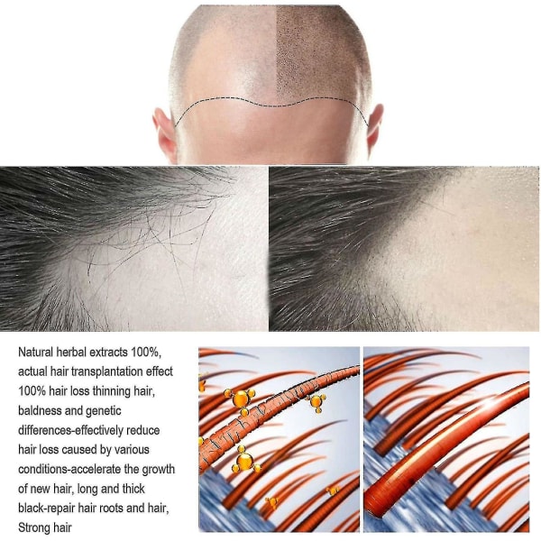 Jaysuing Hårvård Flytande Starkt hår för att förhindra hårrotsmassage Närande flytande Tjock hårbotten null none