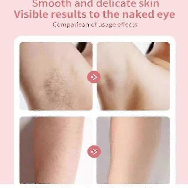 Lumisylk Pro Ansigts Epilator, Lumivyx Lumisylk Pro Hårfjerner Epil Pro 3.0