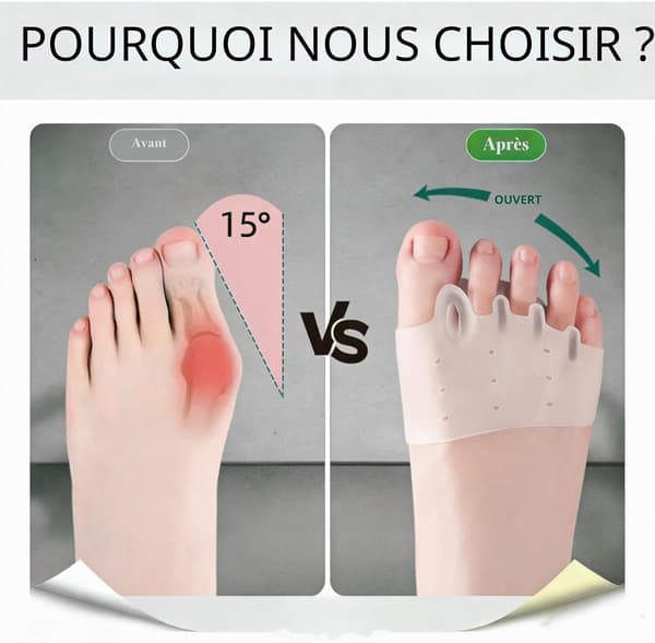 Silikon tåseparator for overlappende tær, Hallux Valgus-korrigerer for avslapning og strekking, korrigerer tær