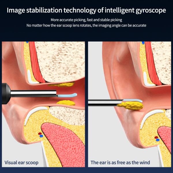 Trådlös öronvaxborttagare Kamera Endoskop sked svart