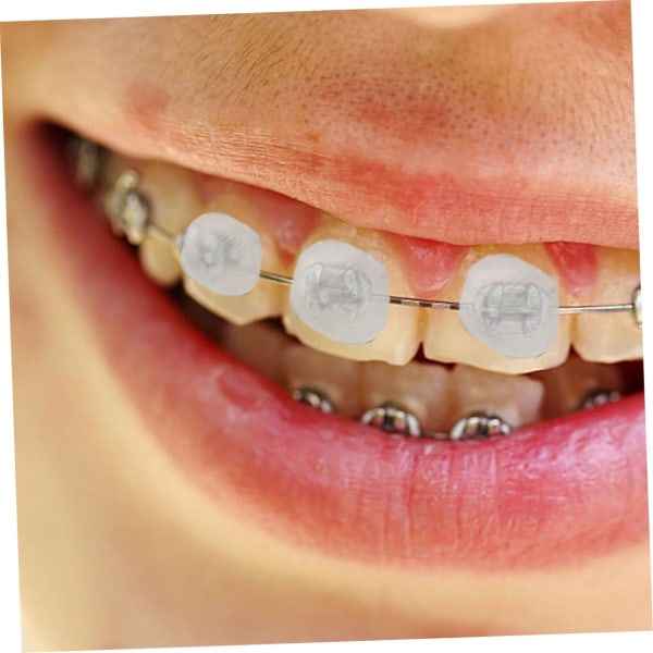 WJ 20 lådor ortodontisk vaxkit korrigeringsfäste skydd resetillbehör vax för fästen grejer för resevax vax Assorted Colorsx2pcs 5.5x3.5x0.8cmx2pcs