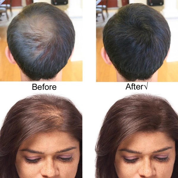 10 färger Förtjockning Hårfiberpulver 50g Hårfibrer Byggförlängningar Pulver Behandling för håravfall Medium Brown