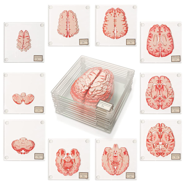 IC Anatomic Brain Specimen Coasters-presenter för medicinska studentpresenter Hjärndekor Mänsklig anatomi gåvor