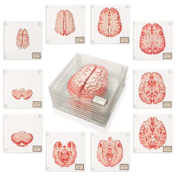 IC Anatomiske Hjerneprøve-Underlag - Præsentation til Medicinstuderende - Hjerne Dekoration - Menneskelig Anatomi Gave