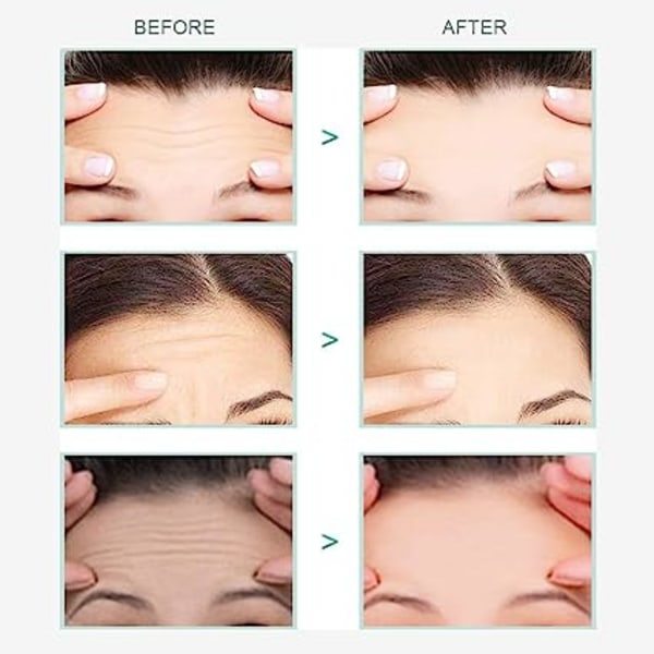 20 stk Ansigtsplaster, Anti Wrinkle Patch, Anti Wrinkle Pande