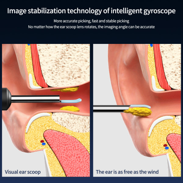 Trådløs ørevoksfjerner Kamera Endoskop ske sort