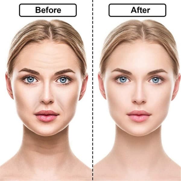 Ansiktsplåster Anti-Aging - Rynkskydd för pannan, Rynkor runt ögonen