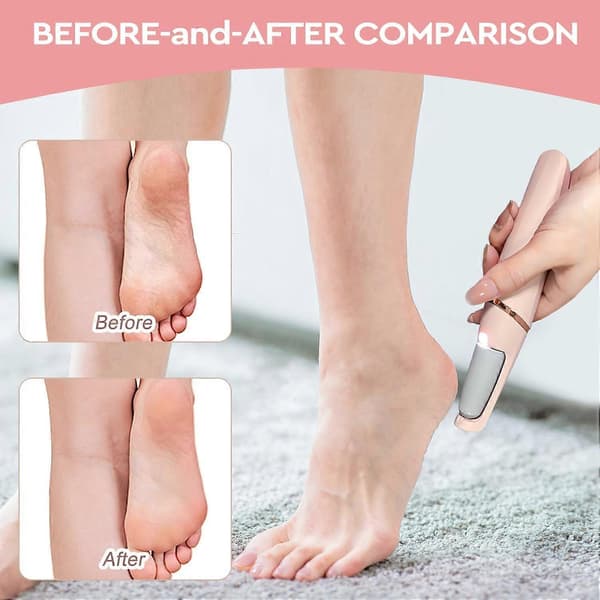 Nuve Smooth Pedicure Wand, Elektrisk Fodfil til Hæle, Ref: 4450