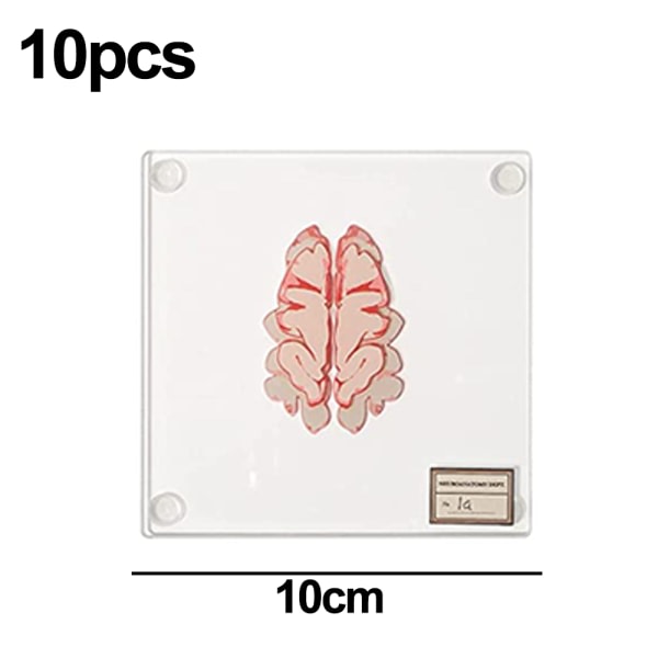 IC Anatomic Brain Specimen Coasters-esiters för medicinska studentpresenter Hjärndekor Mänsklig anatomi gåvor