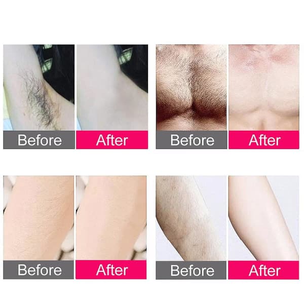 IPL Hårborttakning Laser Epilator 300 000 Flash Barbering og