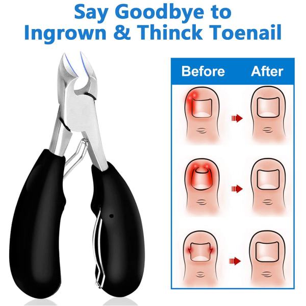 Fotterapeut neglesaks for tykke og inngrodde tånegler og fingernegler