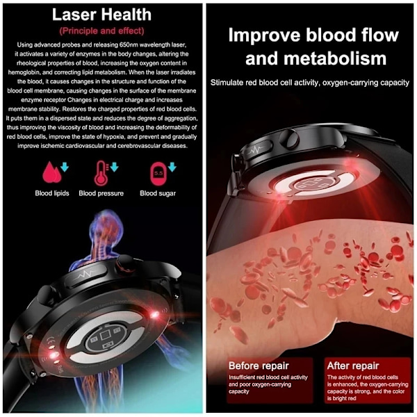 Smärtfri Icke-invasiv Blodsocker Watch Män EKG PPG Laserbehandling Hälsa Blodtryck Sport Smartklocka GlucometerWatch mesh belt