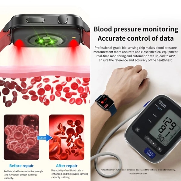 Smärtfri Icke-invasiv åtgärd Blodsocker Watch Män Laserbehandling Blodtryck Hälsa Kvinnor Glukometer Smartwatch Black Mesh Belt