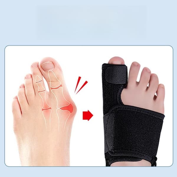 Hallux Valgus Tåskena Bandage Korrigering 1-par_qq