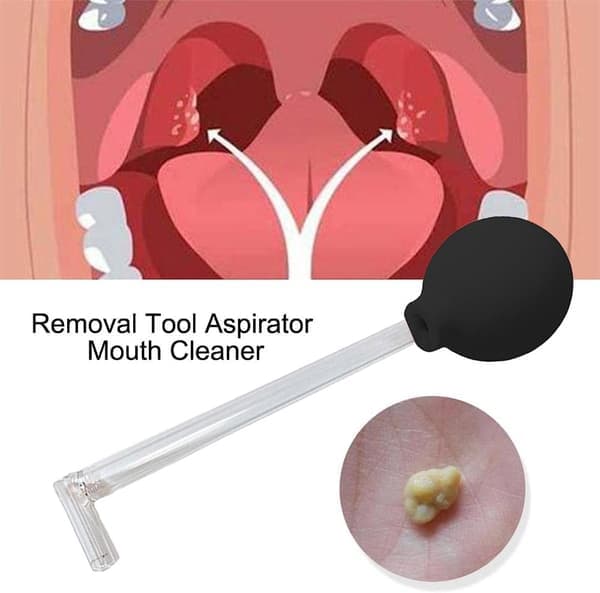 Fjernelsesværktøj til mandelsten