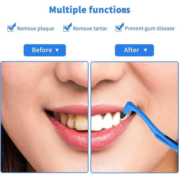 2-delad tandplackborttagare, tandrengöringssats (vit och blå) för att ta bort tandplack och orenheter