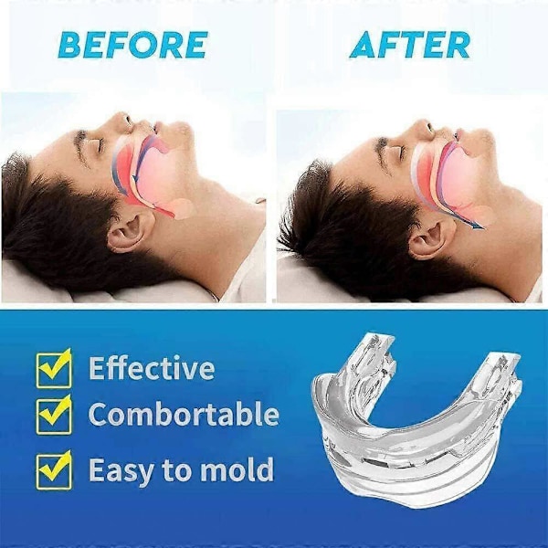 Anti-snork munnstykke - Søvnapnébeskyttelse, snorkestopper, anti-snork munnbeskytter (W)