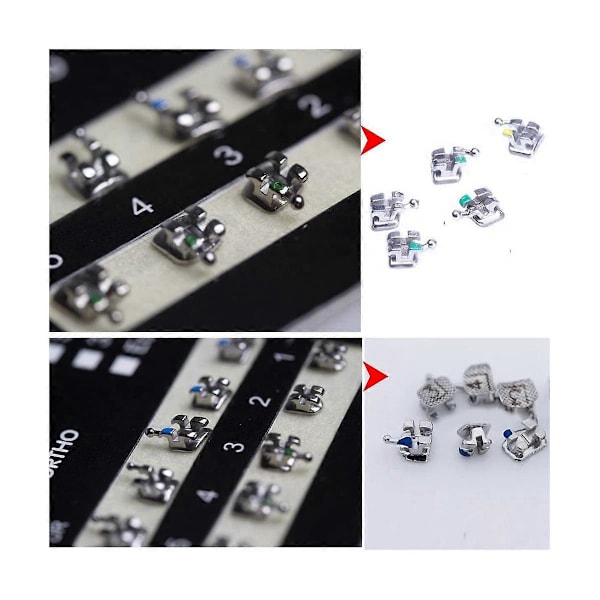 Tannregulering Bracket, Brackets for Tannregulering, 5 Sett 100 Stk Tannregulering Tenner Modell Mini 022 Slot 345 Hoo