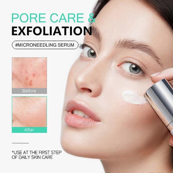 Microneedle Essence Desalination Fine Lines Spots Collagen Solution Reverse Aging Recombinant Improves Rough Texture 50ml Centella Asiatica