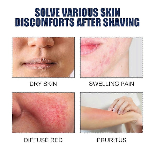 Razor Bump Stopper sisäänkasvaneiden karvojen hoitoon, Razor Bumps -hoito naisille ja miehille, After Shave -liuos sisäänkasvaneille karvoille ja parranajon aiheuttamille palovammoille