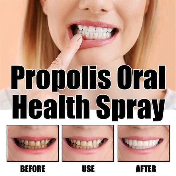 1-3X Propolis munhälsospray, 1/2 st Propolis munspray, fräsch andedräkt 2X