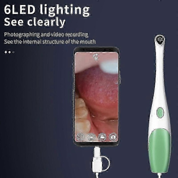 Mobil Oral Endoskop, Intraoralt Endoskop, Intraoralkamera, Dental Endoskopi, Endoskop, Dentalundersökningsendoskop, Oralkamera, Intraoralt Kamerasystem