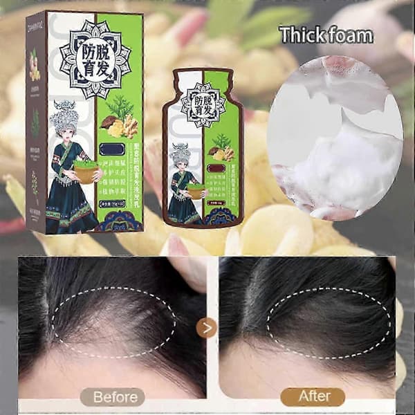 Ingefærplanteekstrakt Anti-Hårtab Hårshampoo, Ingefærshampoo til Hårvækst, Ingefær Anti-Hårtab Hårshampoo til Alle Hårtyper 2Boxes-20pcs