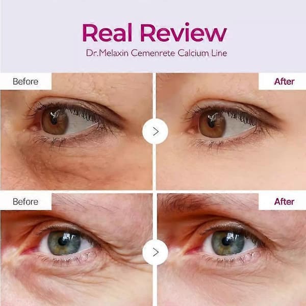 2X Dr.Melaxin Anti-Aging Øjencreme Cemenrete Calcium Volume Multi Balm Rynkestift