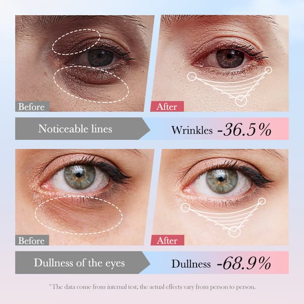 SADOER 4IN1 Roll-on silmänympärysvoide 20g