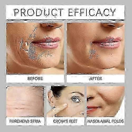 Botoxin Bliss Elixir Anti-Aging Serum, 30ml Anti-Aging Oppstrammende Serum, Reduserer Fine Linjer og Rynker Ny Ankomst S04 2Pcs