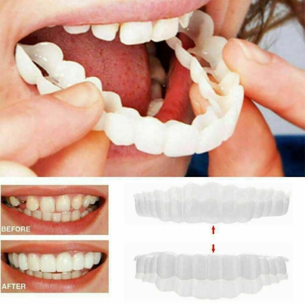 1 sæt bærbare, smil-snap-on tandfinerer