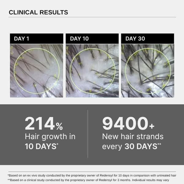 2-pack specialerbjudande Bare Anatomy Advanced Hair Growth Serum (1-3 tuber) - 30ml