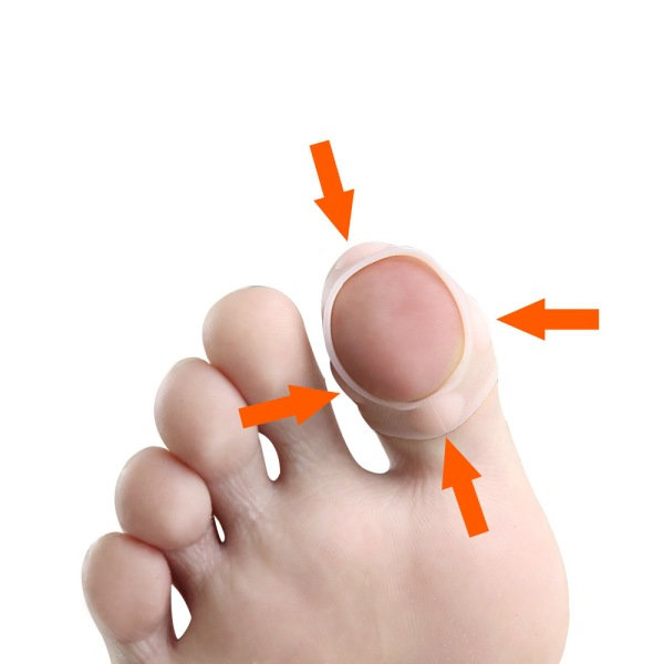 Ingrodda tånagelkorrigeringshylsor, 4 par elastisk silikon ingrowth
