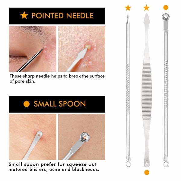 (Spesialkampanje) CQBB Blackhead Remover, Pimple Popper i rustfritt stål