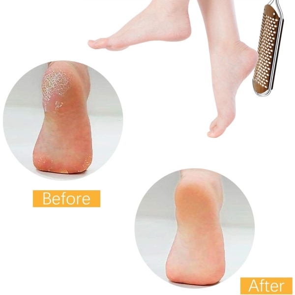 Foot File Callus Remover - Pedikyrfil i rostfritt stål för våta och torra fötter